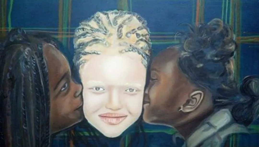 Un Congolais peint des albinos “pour lutter contre leur stigmatisation”